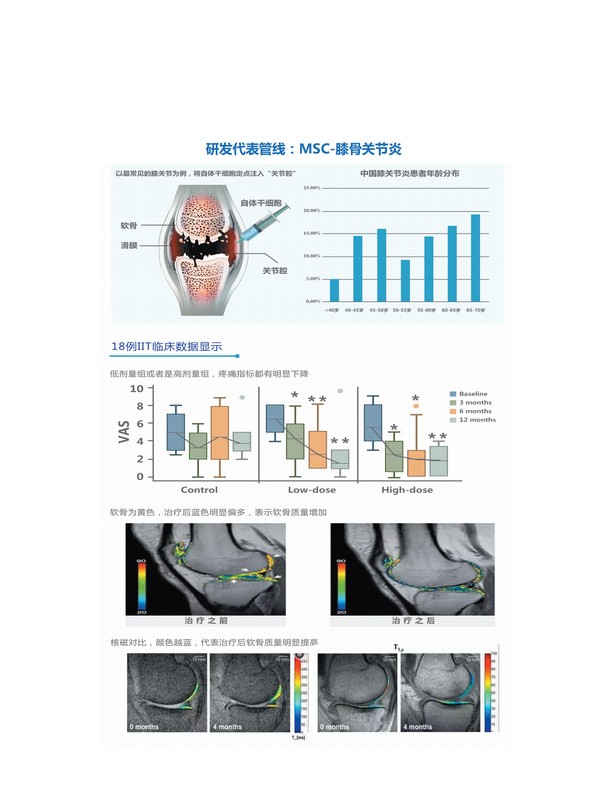 MSC-膝骨关节炎