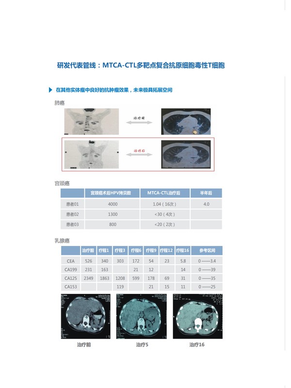 MTCA-CTL多靶点复合抗原细胞毒性T细胞